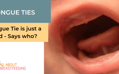 Tongue Tie is just a fad – Says who?
